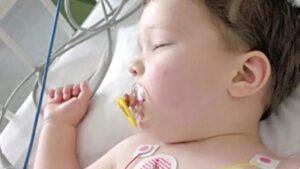 اعراض صمام القلب عند الاطفال