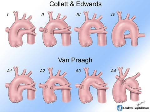 الجذع الشرياني المشترك 4 الجذع الشرياني المشترك