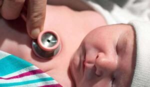 انعكاس الشرايين عند الاطفال