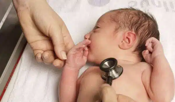 انعكاس الشرايين الكبرى عند الاطفال