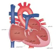 رتق الصمام الرئوي