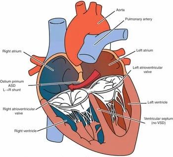 الصفحة الرئيسية 8 عيب القناة الاذينية البطينية