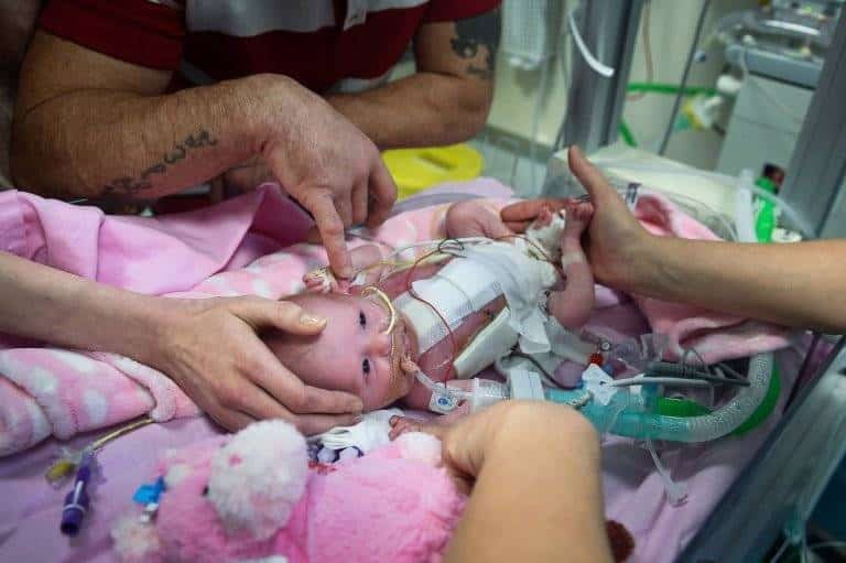 مضاعفات عملية القلب المفتوح عند الرضع 4 مضاعفات عملية القلب المفتوح عند الرضع