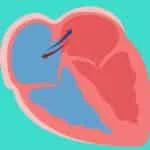 ما أنواع ثقب القلب في الاطفال وأعراض الإصابة به ؟ 5 أنواع ثقب القلب في الاطفال