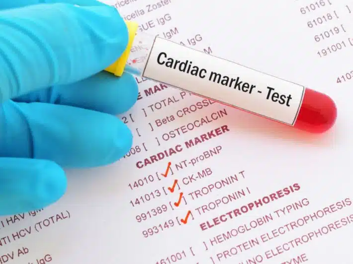 الصفحة الرئيسية 4 التحاليل المطلوبة قبل عملية القلب المفتوح