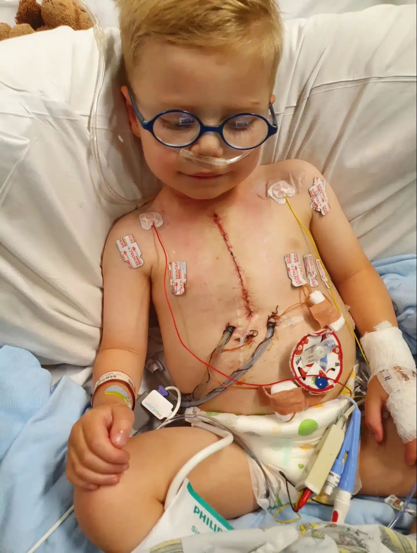 ابني محتاج عملية اصلاح للعيب القلبي وانا خايفه اعمل ايه 1 ابني محتاج عملية اصلاح للعيب القلبي وانا خايفه اعمل ايه