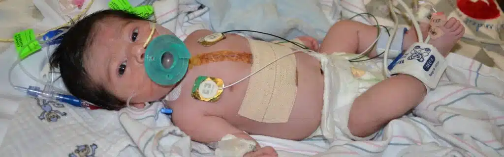ابني محتاج عملية اصلاح للعيب القلبي وانا خايفه اعمل ايه