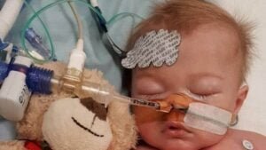 اضرار عملية القلب المفتوح للاطفال