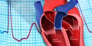 احصار القلب عند الاطفال