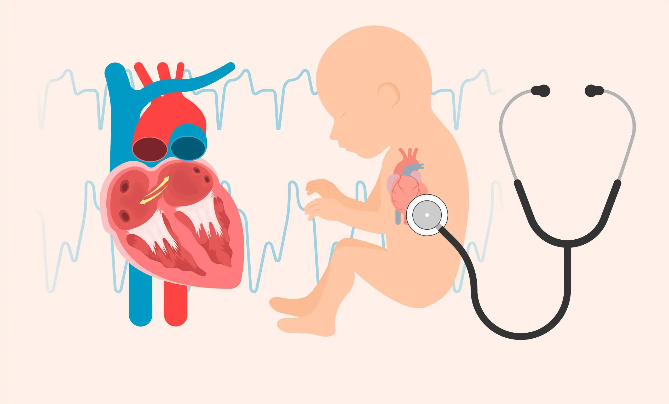 اسباب عيوب القلب الخلقية عند الاطفال