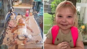 النقاهة بعد عملية القلب المفتوح