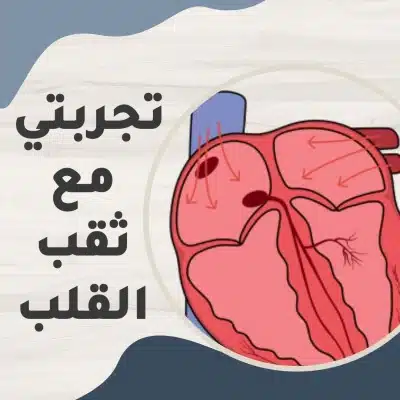 تجربتي مع اصلاح ثقب بين الاذينين