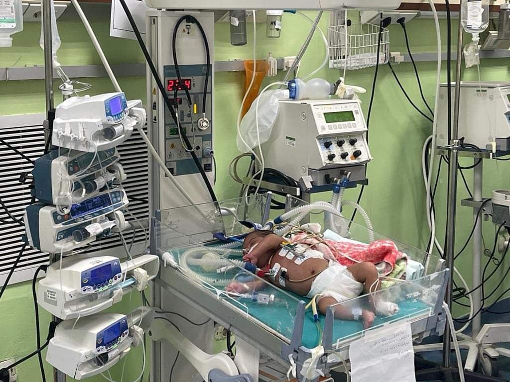 تجربتي مع عملية القلب المفتوح للأطفال