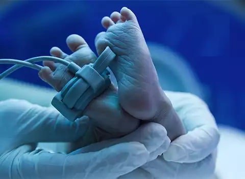 رباعية فالوت عند حديثي الولادة 2 رباعية فالوت عند حديثي الولادة