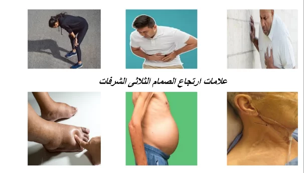 ارتجاع الصمام ثلاثي الشرفات عند الأطفال 4 ارتجاع الصمام ثلاثي الشرفات عند الأطفال