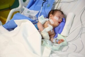 كيفية التحضير لعملية القلب المفتوح للاطفال