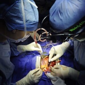 مخاطر عملية القلب المفتوح للاطفال