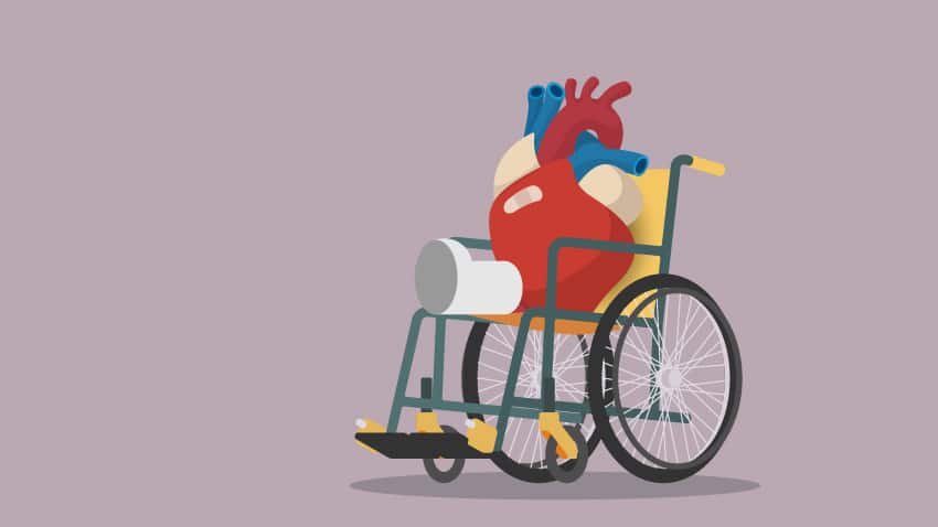 مدة عملية القلب المفتوح وفترة التعافي 5 النقاهة بعد القلب المفتوح