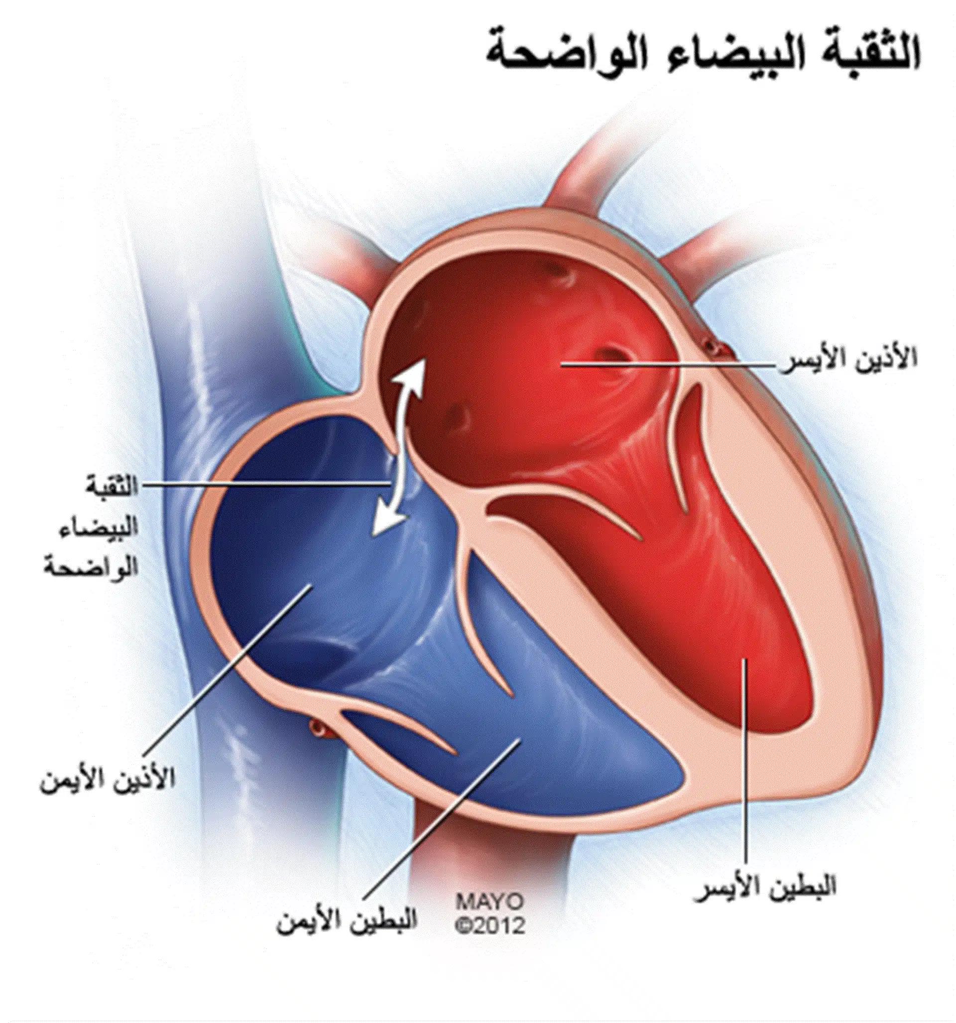 الثقب الجنيني في القلب