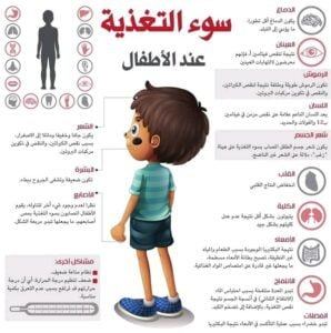 سوء التغذية عند الاطفال