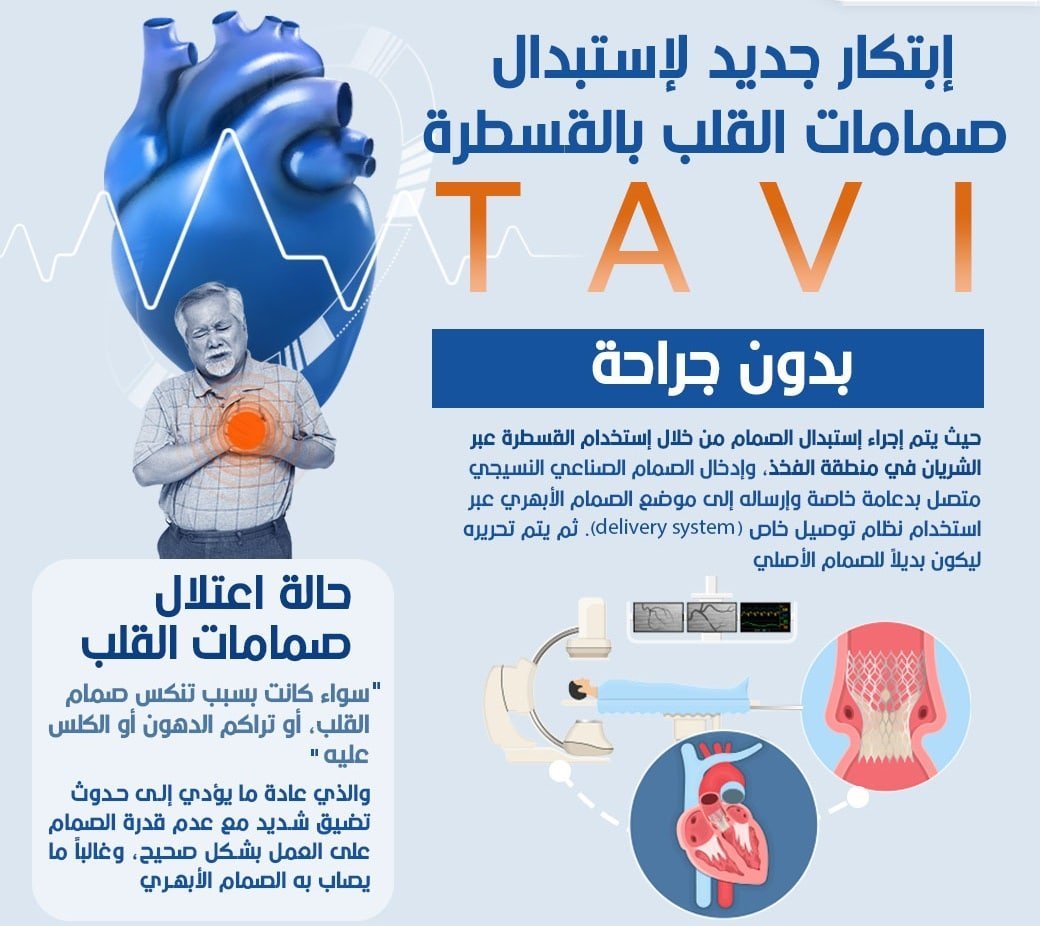 علاج صمامات القلب دون جراحة 2024 4 علاج صمامات القلب دون جراحة