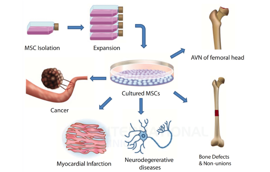 الخلايا الجذعية المتوسطة (MSCs)