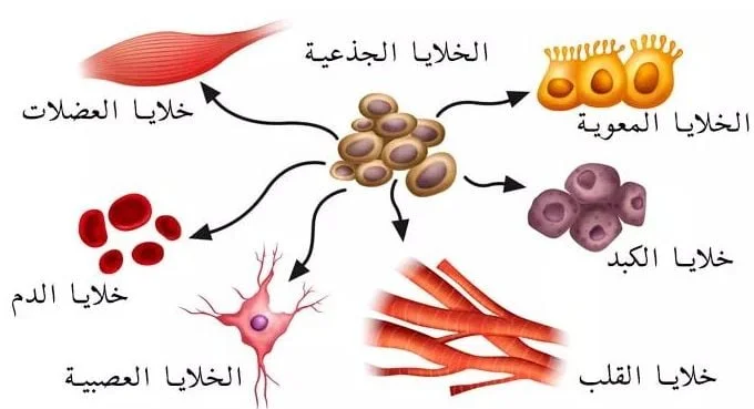 العلاج بالخلايا الجذعية لقلب الاطفال
