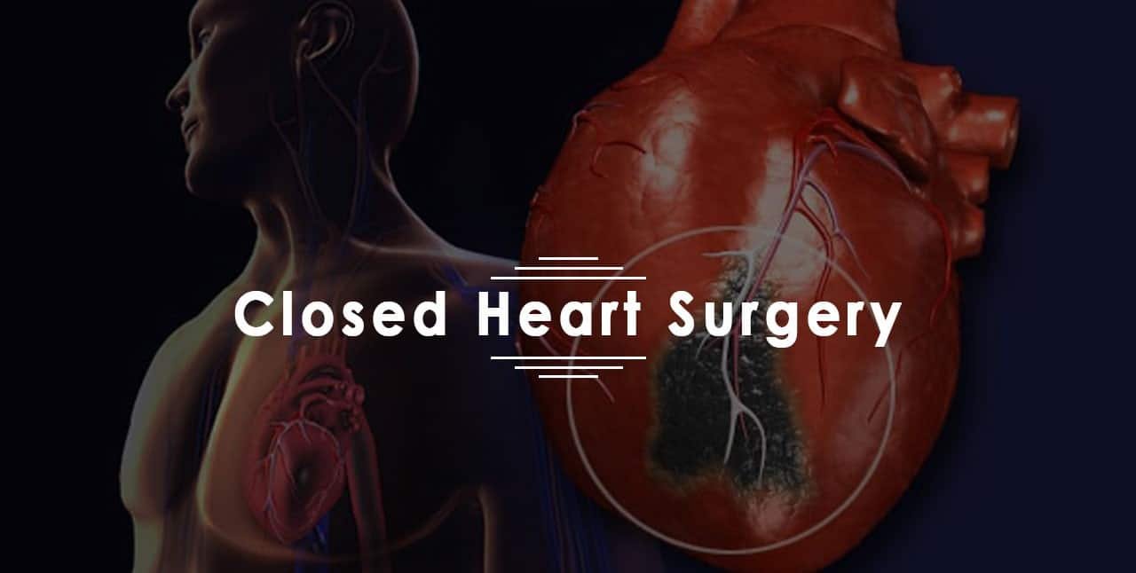 جراحة القلب المغلق