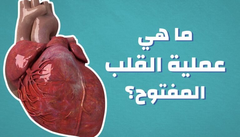 جراحة القلب المفتوح 6 خطوات عملية القلب المفتوح