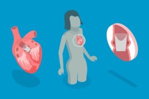 علاج صمامات القلب دون جراحة