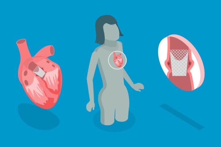 علاج صمامات القلب دون جراحة 2024 1 علاج صمامات القلب دون جراحة