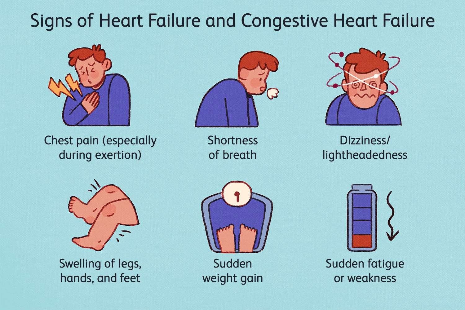 Сердечная недостаточность 30. Heart failure. Congestive Heart failure.